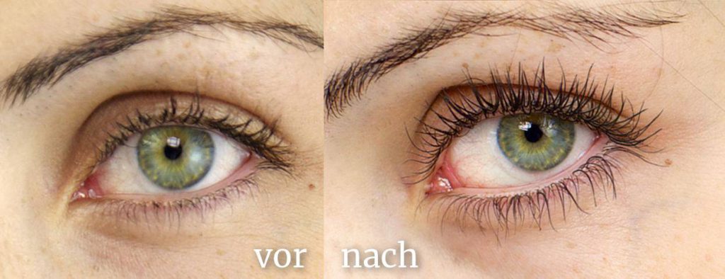 Nanolash-vor-nach